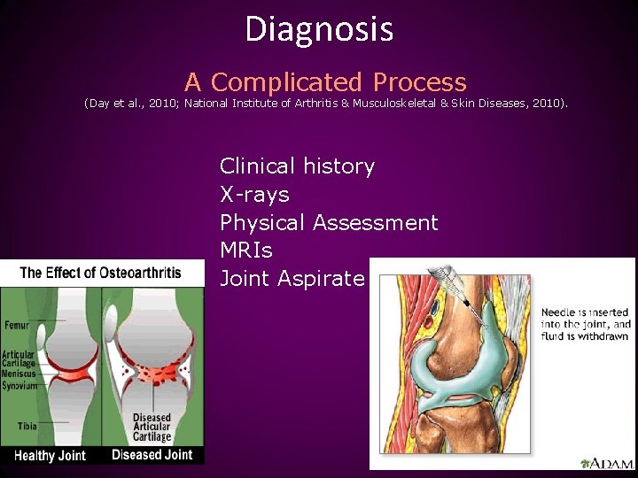 Diagnosis A Complicated Process (Day et al. , 2010; National Institute of Arthritis &