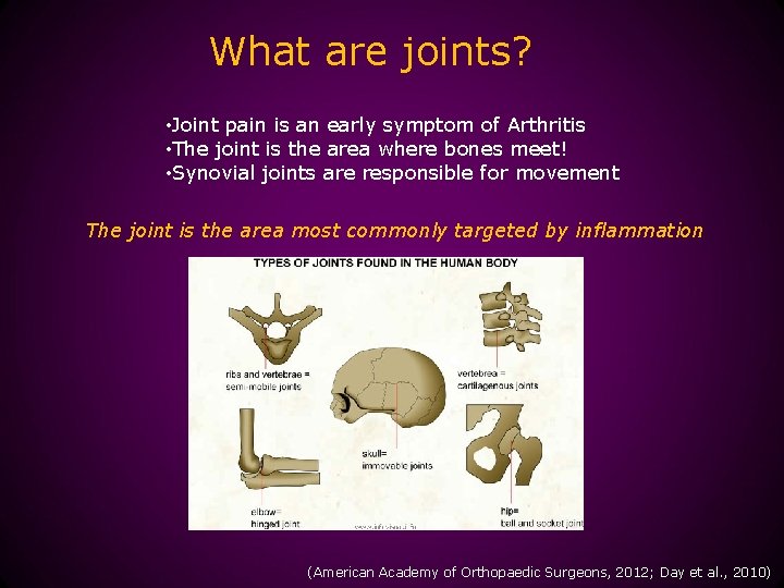 What are joints? • Joint pain is an early symptom of Arthritis • The