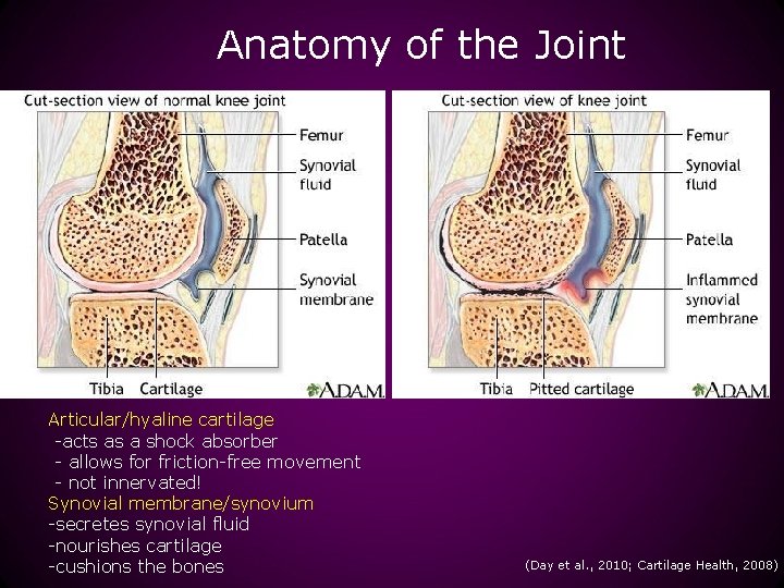 Anatomy of the Joint Articular/hyaline cartilage -acts as a shock absorber - allows for