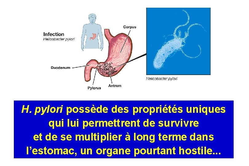 H. pylori possède des propriétés uniques qui lui permettrent de survivre et de se