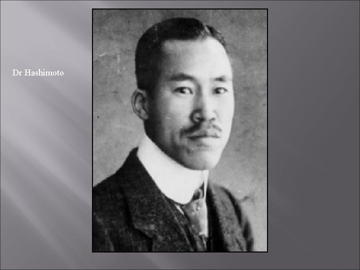 Dr Hashimoto 