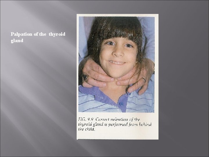 Palpation of the thyroid gland 