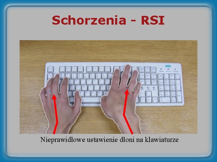Schorzenia - RSI Nieprawidłowe ustawienie dłoni na klawiaturze 