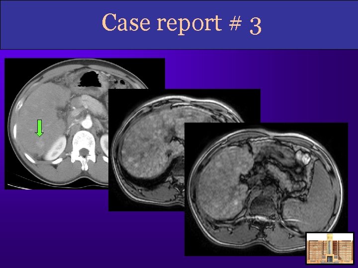 Case report # 3 