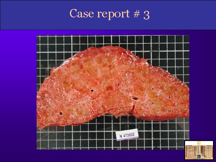 Case report # 3 