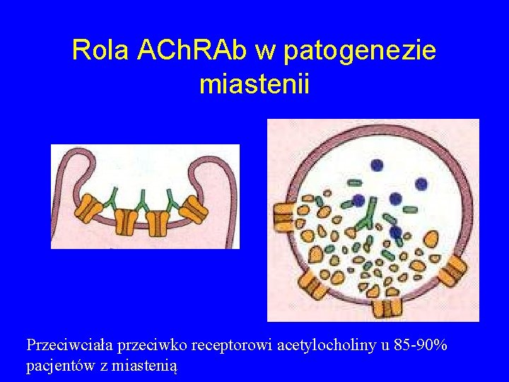 Rola ACh. RAb w patogenezie miastenii Przeciwciała przeciwko receptorowi acetylocholiny u 85 -90% pacjentów