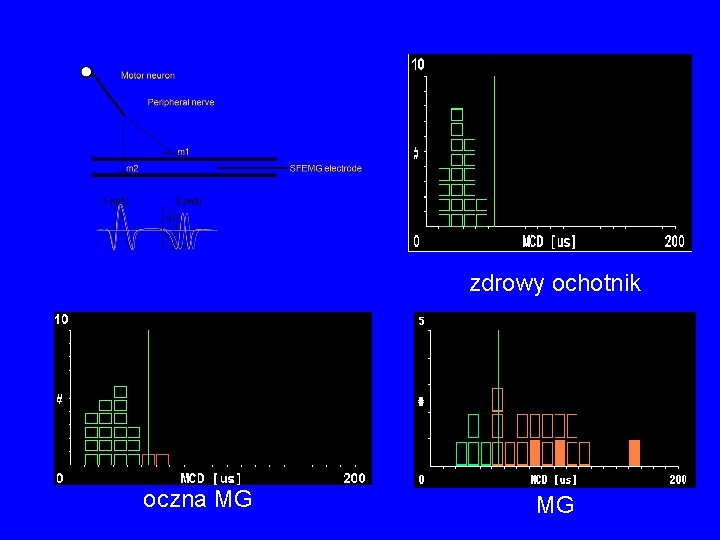 zdrowy ochotnik oczna MG MG 