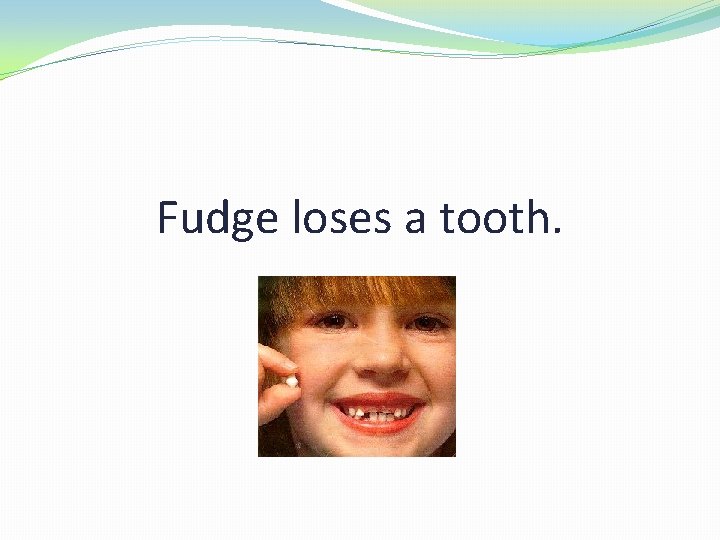 Fudge loses a tooth. 