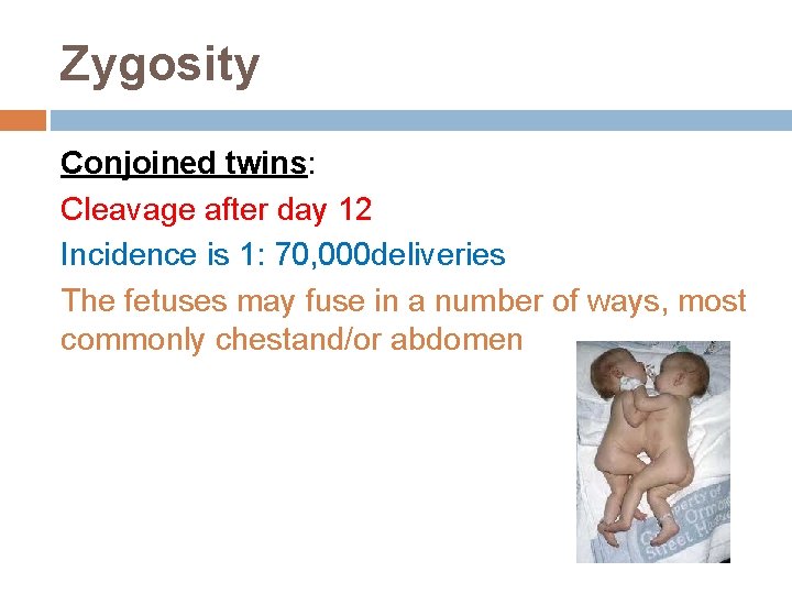 Zygosity Conjoined twins: Cleavage after day 12 Incidence is 1: 70, 000 deliveries The