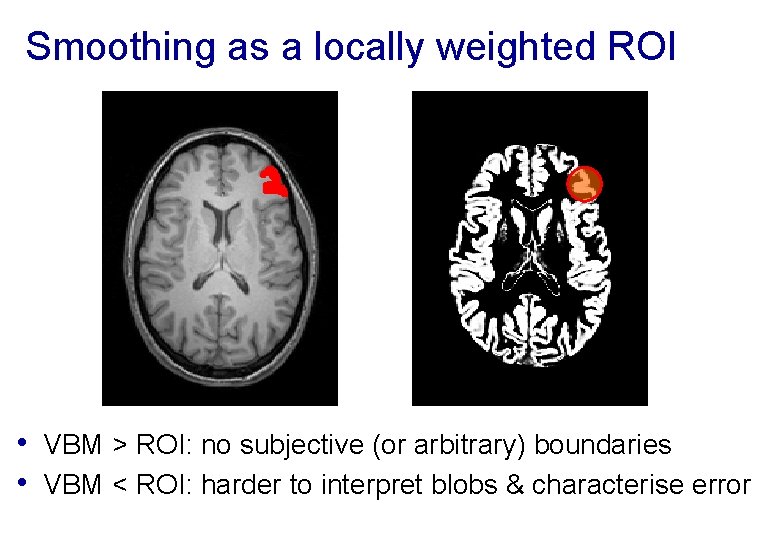 Smoothing as a locally weighted ROI • VBM > ROI: no subjective (or arbitrary)