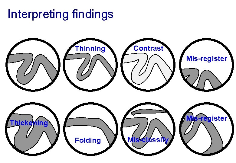 Interpreting findings Thinning Contrast Mis-register Thickening Folding Mis-classify 