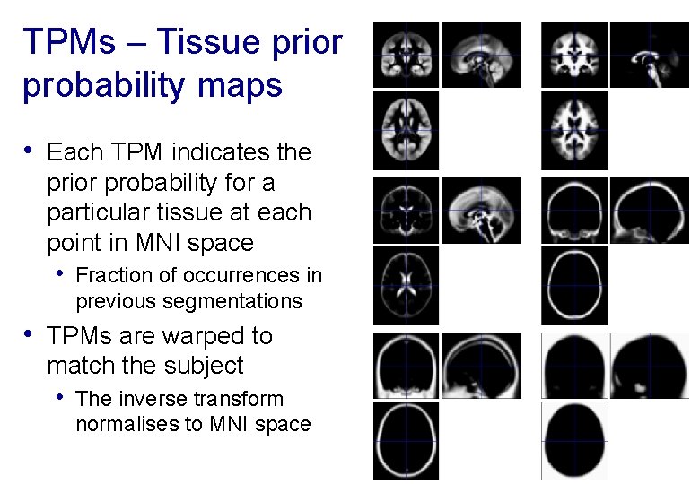 TPMs – Tissue prior probability maps • Each TPM indicates the prior probability for