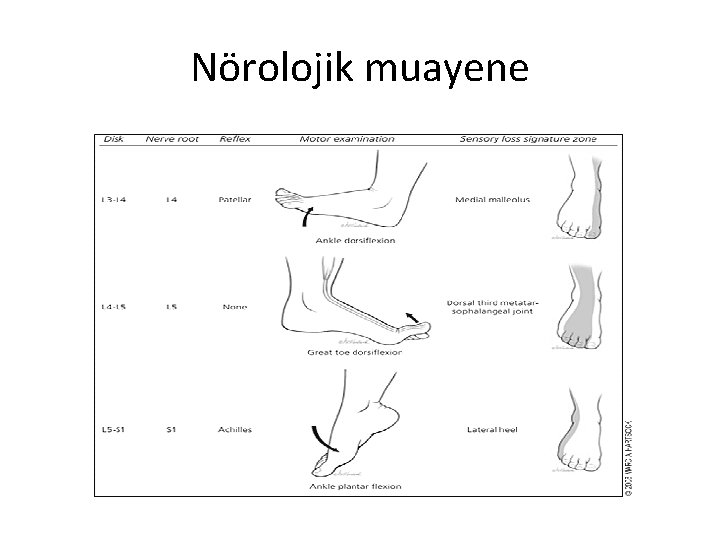 Nörolojik muayene 