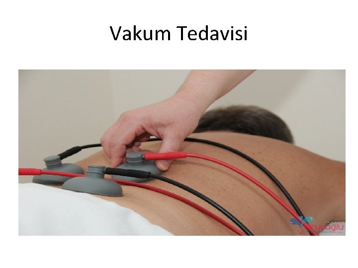 Vakum Tedavisi 