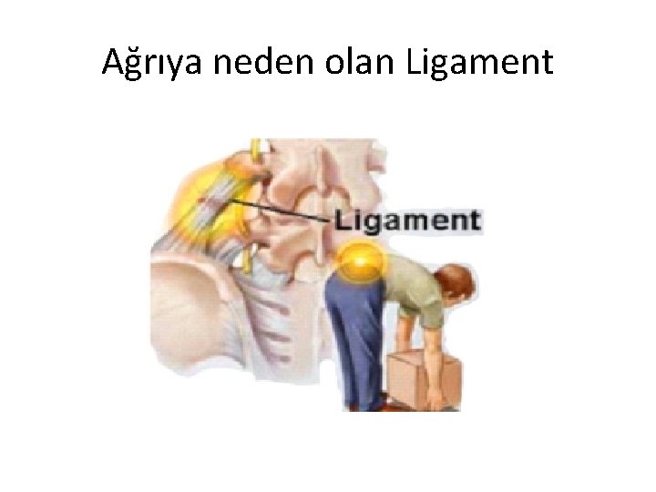 Ağrıya neden olan Ligament 