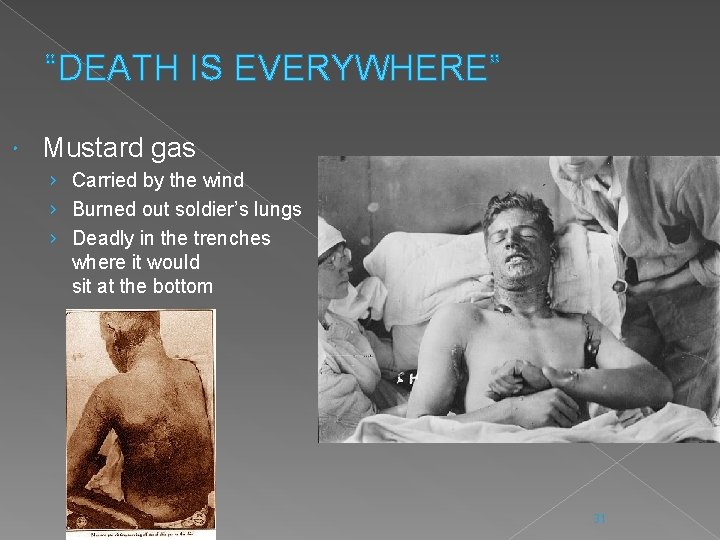 “DEATH IS EVERYWHERE” Mustard gas › Carried by the wind › Burned out soldier’s