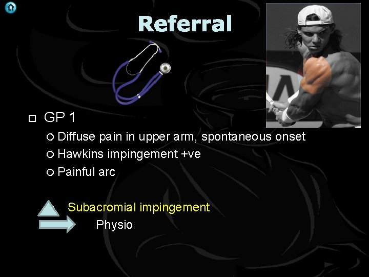 Referral GP 1 Diffuse pain in upper arm, spontaneous onset Hawkins impingement +ve Painful