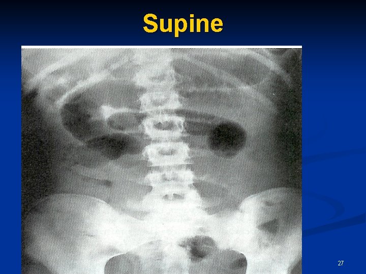 Supine 27 