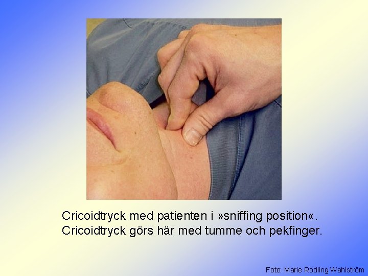 Cricoidtryck med patienten i » sniffing position «. Cricoidtryck görs här med tumme och