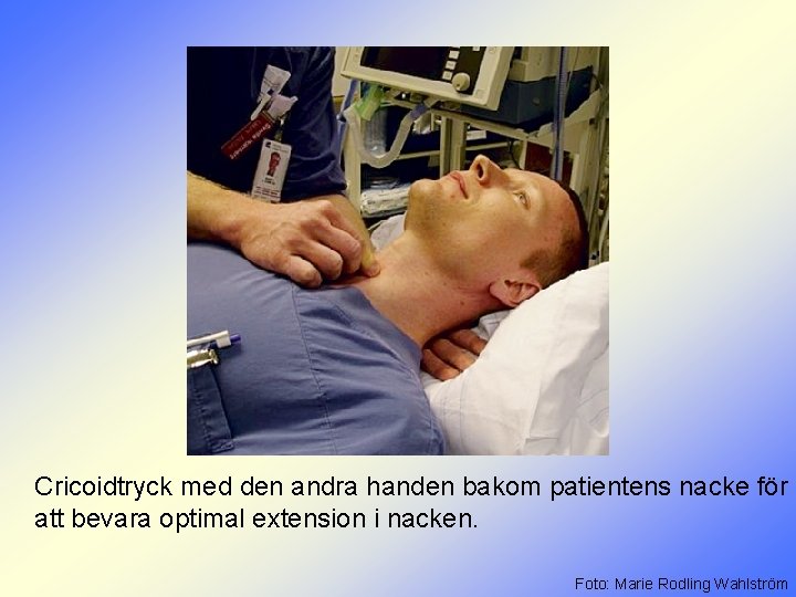 Cricoidtryck med den andra handen bakom patientens nacke för att bevara optimal extension i