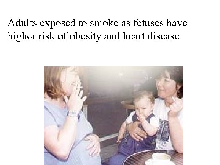 Adults exposed to smoke as fetuses have higher risk of obesity and heart disease