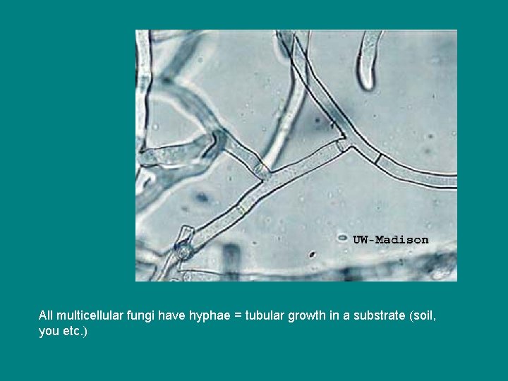 All multicellular fungi have hyphae = tubular growth in a substrate (soil, you etc.