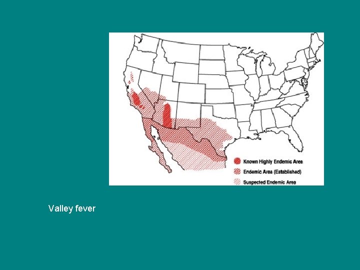 Valley fever 