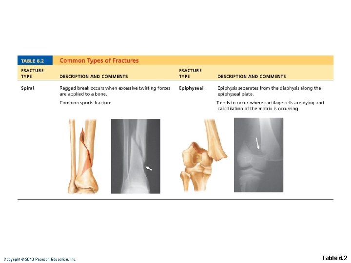 Copyright © 2010 Pearson Education, Inc. Table 6. 2 