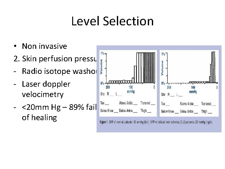 Level Selection • Non invasive 2. Skin perfusion pressures - Radio isotope washout -