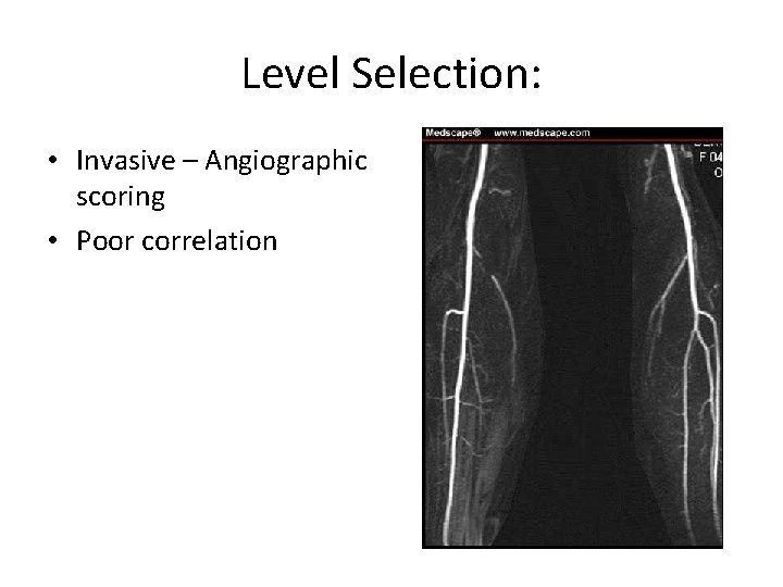 Level Selection: • Invasive – Angiographic scoring • Poor correlation 