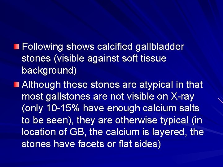 Following shows calcified gallbladder stones (visible against soft tissue background) Although these stones are