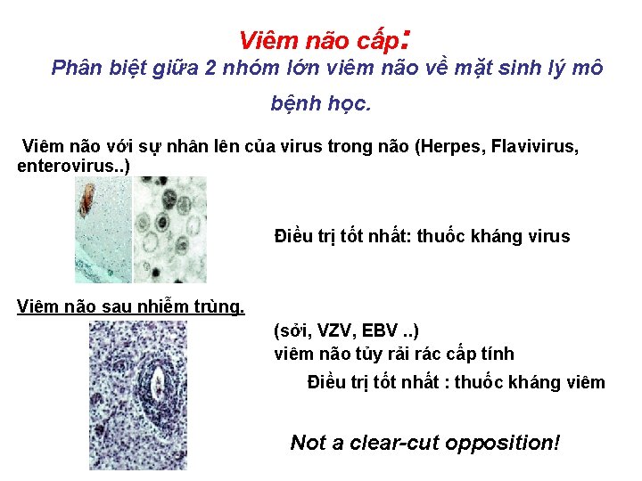  Viêm não cấp: Phân biệt giữa 2 nhóm lớn viêm não về mặt