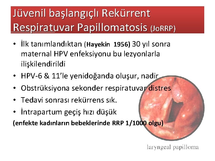 Jüvenil başlangıçlı Rekürrent Respiratuvar Papillomatosis (Jo. RRP) • İlk tanımlandıktan (Hayekin 1956) 30 yıl