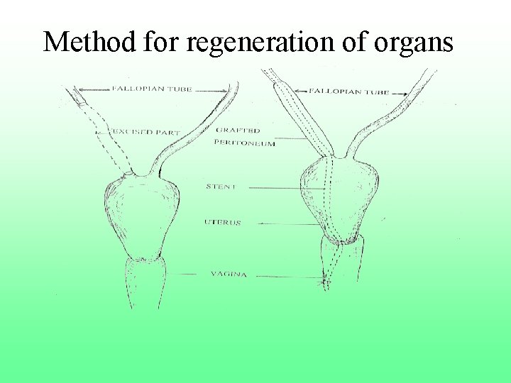 Method for regeneration of organs 