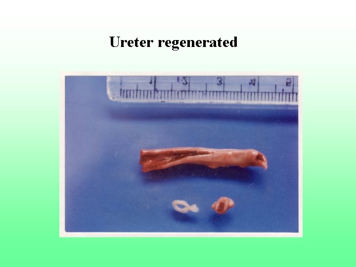 Ureter regenerated 