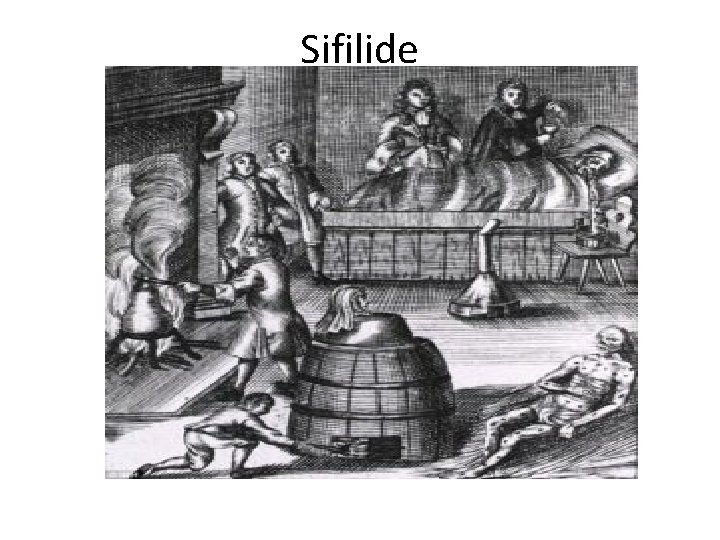 Sifilide 