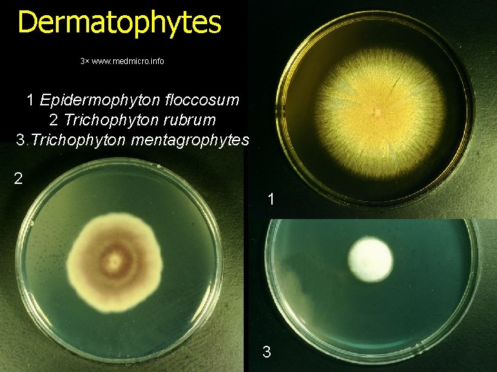 Dermatophytes 3× www. medmicro. info 1 Epidermophyton floccosum 2 Trichophyton rubrum 3. Trichophyton mentagrophytes