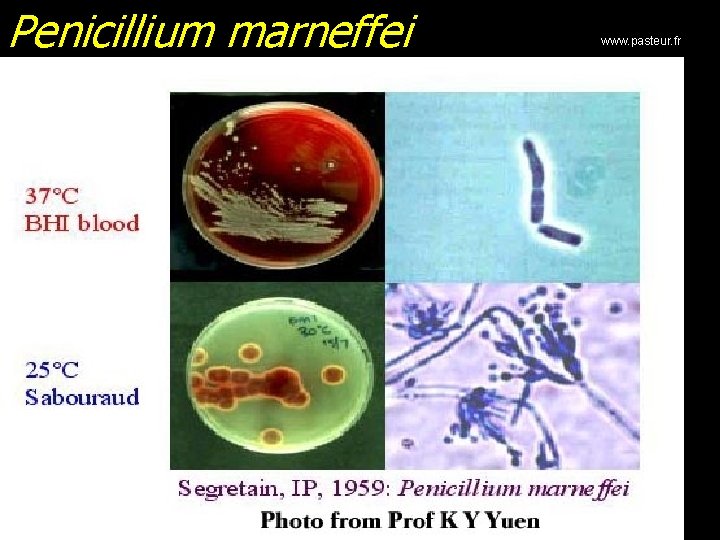 Penicillium marneffei www. pasteur. fr 