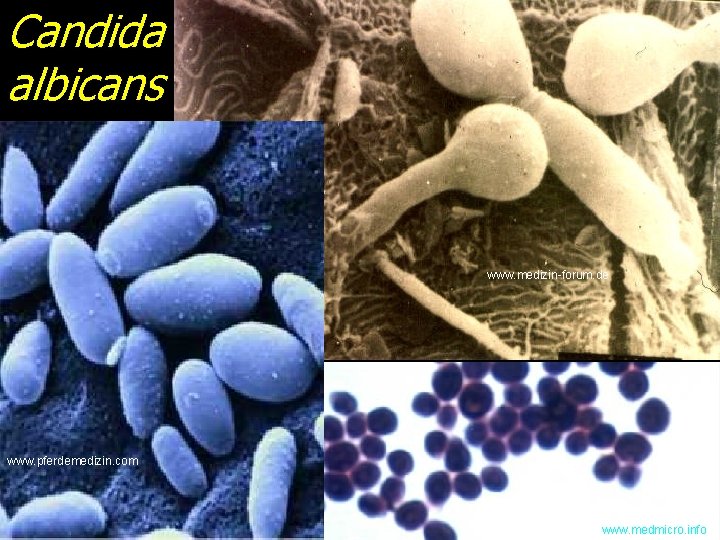 Candida albicans www. medizin-forum. de www. pferdemedizin. com www. medmicro. info 