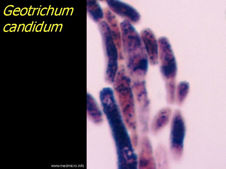 Geotrichum candidum www. medmicro. info 