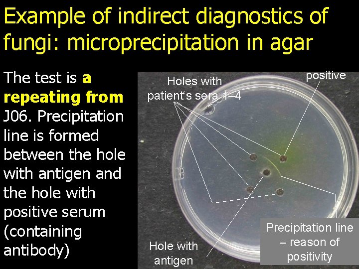 Example of indirect diagnostics of fungi: microprecipitation in agar The test is a repeating