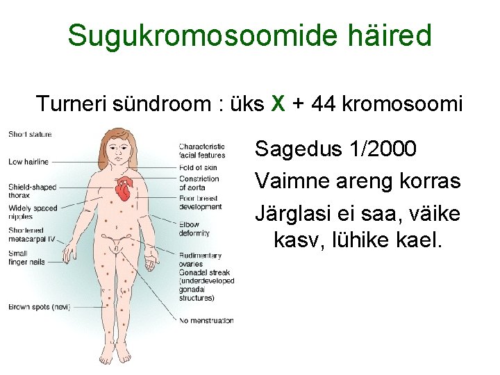 Sugukromosoomide häired Turneri sündroom : üks X + 44 kromosoomi Sagedus 1/2000 Vaimne areng