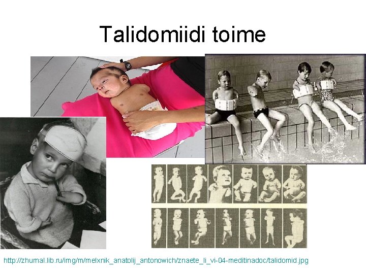 Talidomiidi toime http: //zhurnal. lib. ru/img/m/melxnik_anatolij_antonowich/znaete_li_vi-04 -meditinadoc/talidomid. jpg 