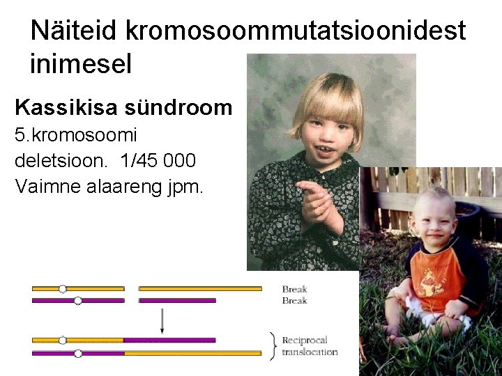 Näiteid kromosoommutatsioonidest inimesel Kassikisa sündroom 5. kromosoomi deletsioon. 1/45 000 Vaimne alaareng jpm. 