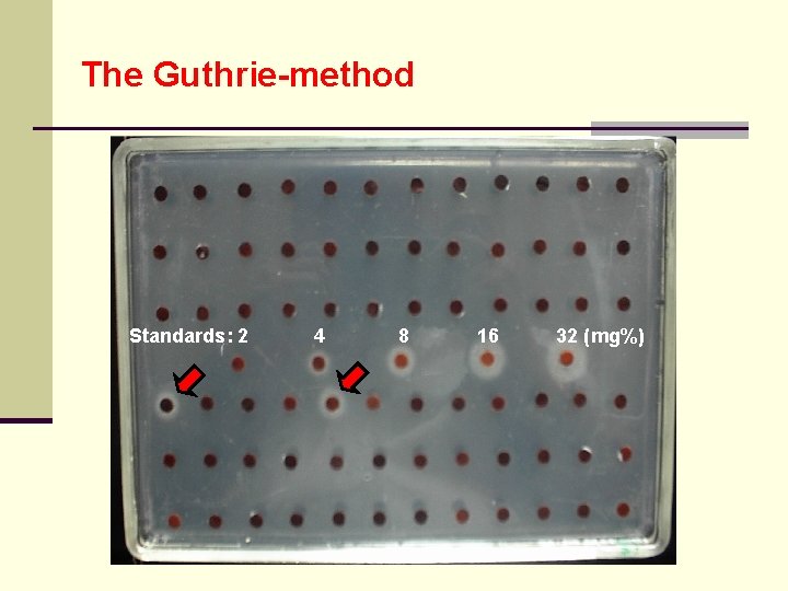 The Guthrie-method Standards: 2 4 8 16 32 (mg%) 