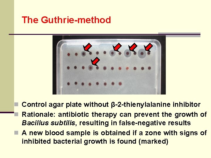 The Guthrie-method n Control agar plate without β-2 -thienylalanine inhibitor n Rationale: antibiotic therapy