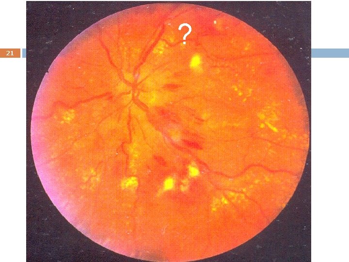 21 ? 