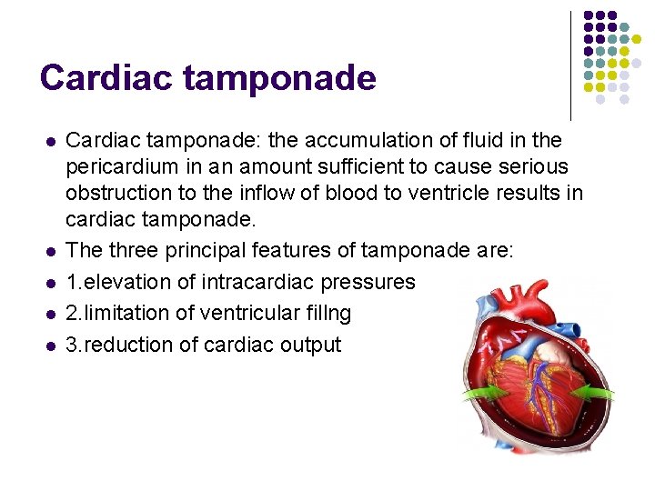 Cardiac tamponade l l l Cardiac tamponade: the accumulation of fluid in the pericardium