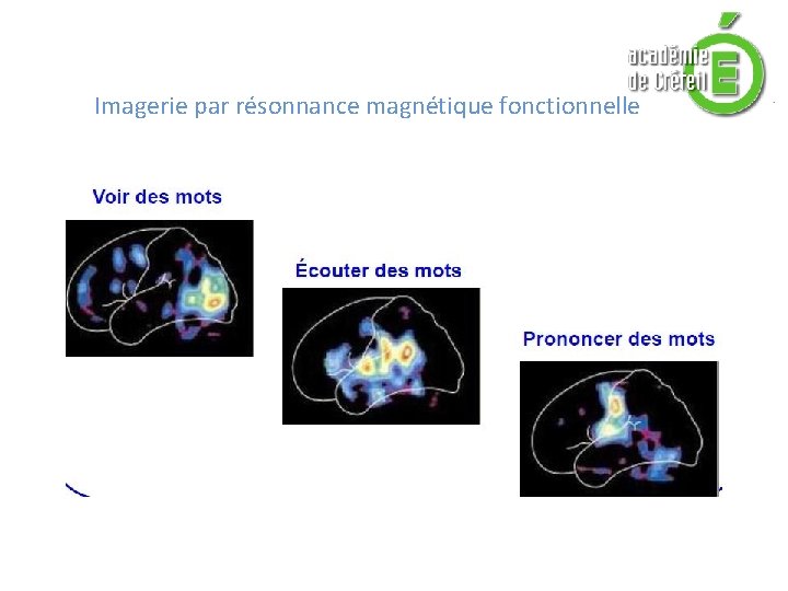 Imagerie par résonnance magnétique fonctionnelle Imagerie par résonnance magnétique fonctionnelle