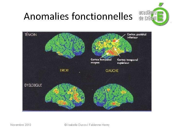 Anomalies fonctionnelles Novembre 2010 © Isabelle Ducos / Fabienne Henry 